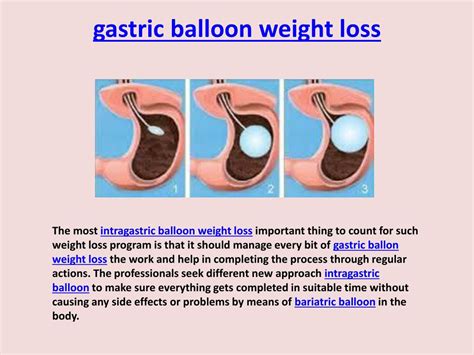 obesity balloon in stomach to lose weight